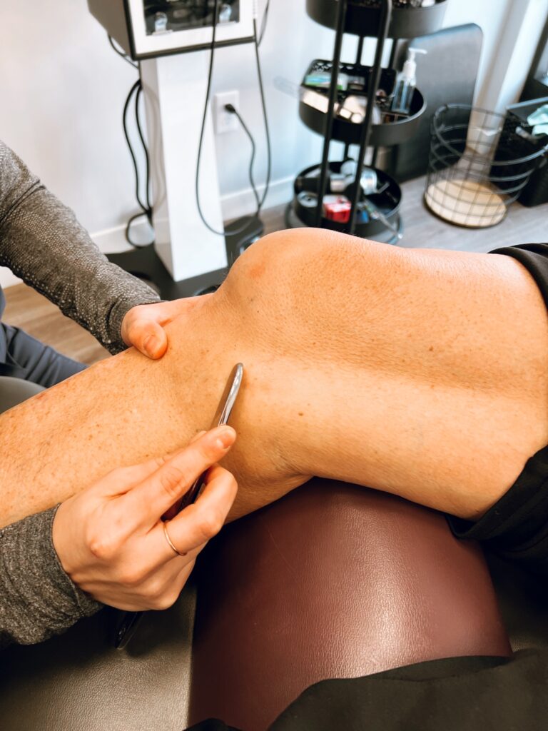 Graston Technique® on a patient’s knee at Excelsior & Grand Chiropractic in St. Louis Park, MN